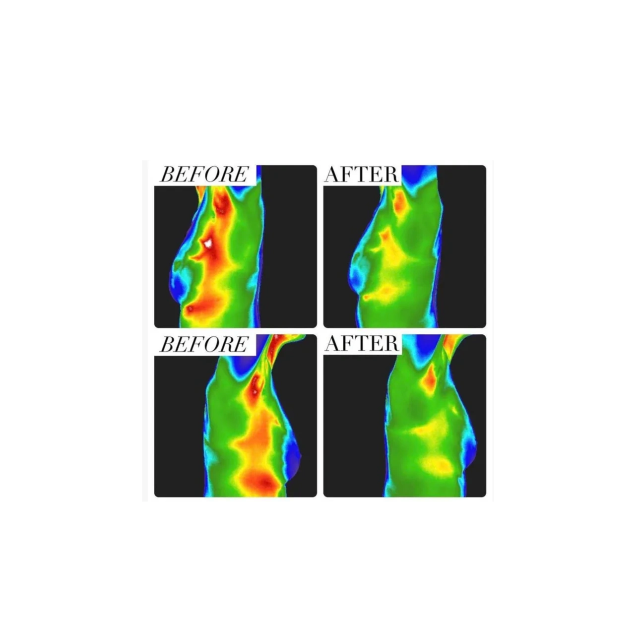 Did you know you have a Glymphatic System? Lymph in your brain!