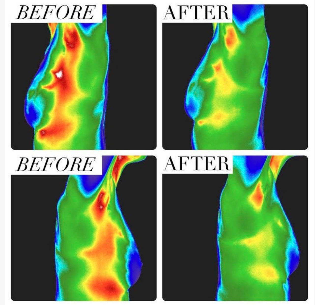Thermography Scans
